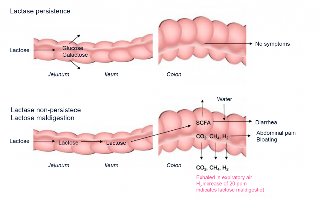 Lactose Intolerance What It Is Types Symptoms How To Diagnose And Lactose Intolerance What It Is Types Symptoms How To Diagnose And