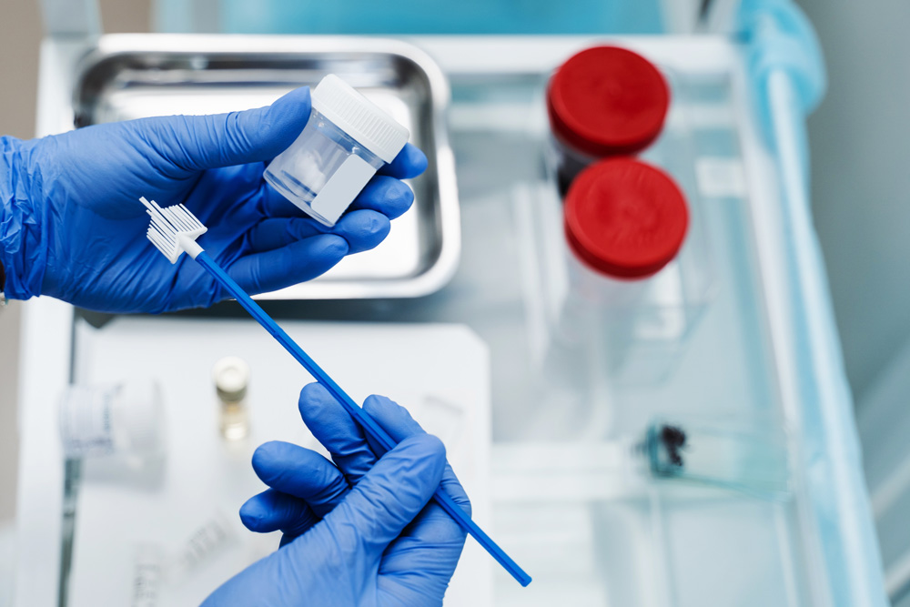 Exame de HPV: entenda quais os tipos e quando realizar